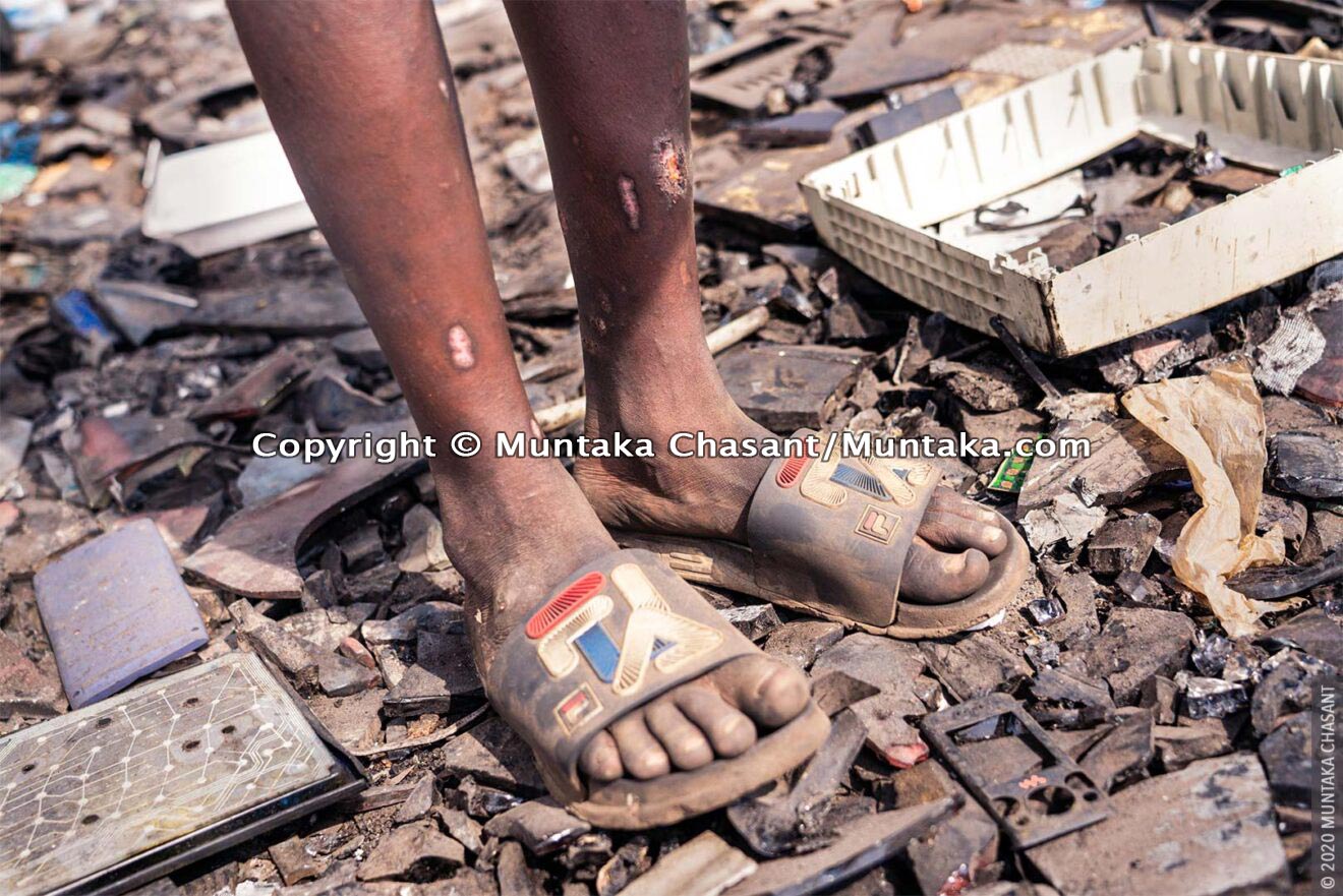 Hazardous child labour: A 13 years old boy engaged in hazardous child labour at Agbogbloshie, Ghana, is cut by a broken CRT glass. © 2020 Muntaka Chasant